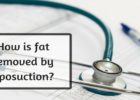 How is fat removed by liposuction