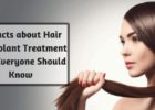 10 Facts about Hair Transplant Treatment that Everyone Should Know