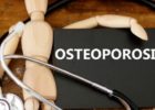 Everything You Ought to Know About Osteoporosis
