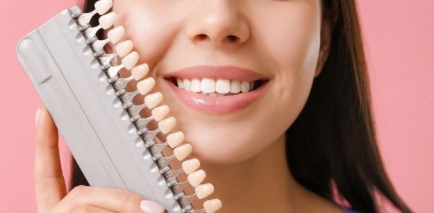 Essential Tips on How You Can Preserve Your Dental Veneers in Sydney