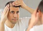 What Are Some Effective Ways to Treat Male Pattern Baldness