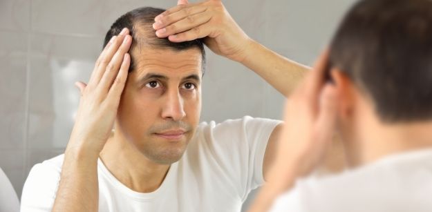 What Are Some Effective Ways to Treat Male Pattern Baldness