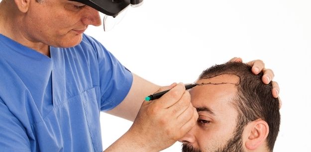 How to Get Best Results From Services of Hair Transplant Specialists