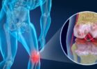 Knee Pain - Symptoms, Causes and Remedies