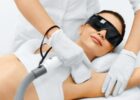 5 Reasons to Try Laser Hair Removal