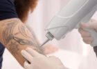 How to Pursue Tattoo Removal as a Career
