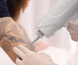 How to Pursue Tattoo Removal as a Career